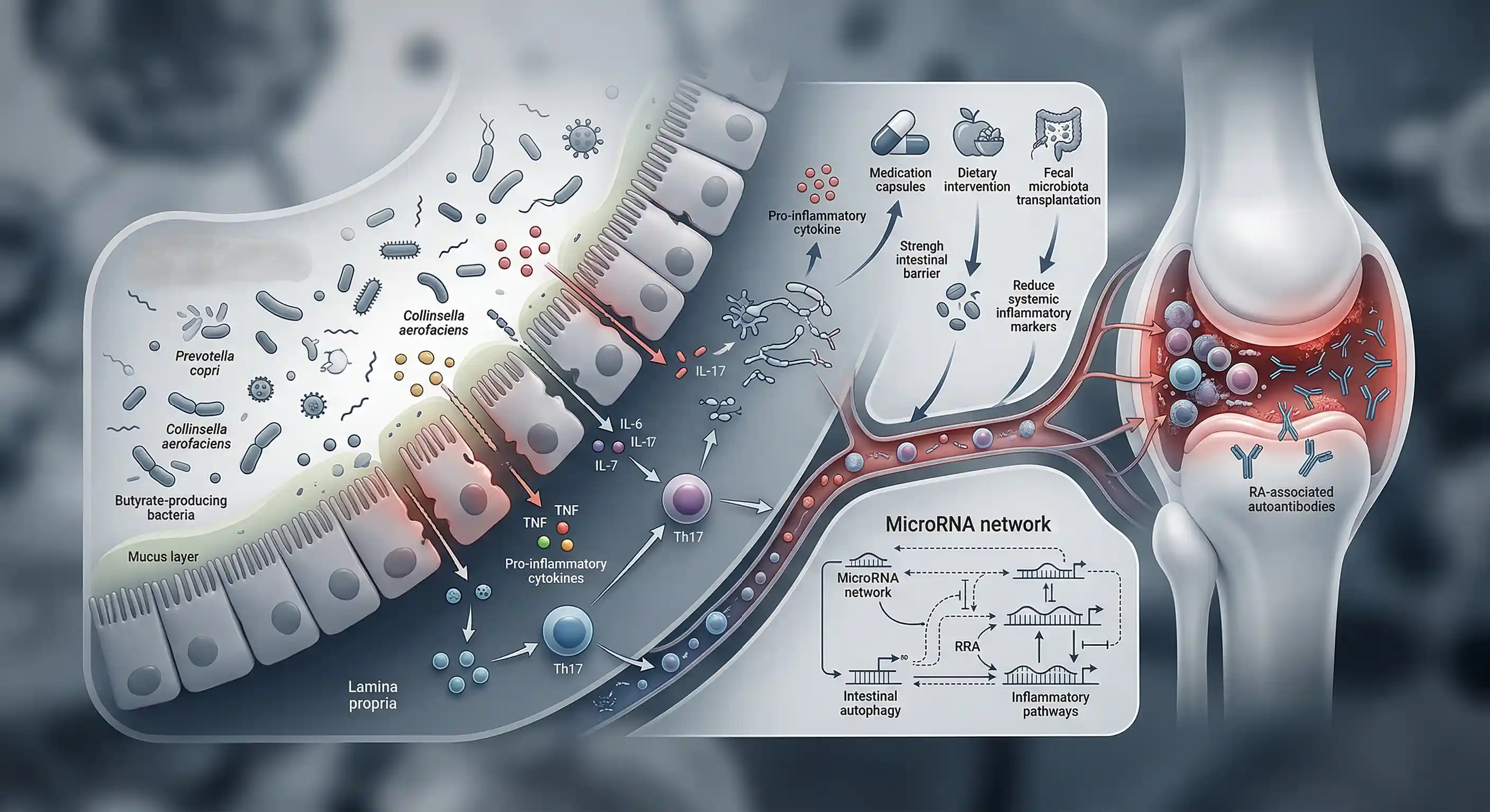 Gut microbiota in rheumatoid arthritis